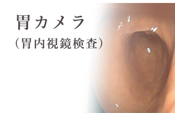 胃カメラ（胃内視鏡検査）